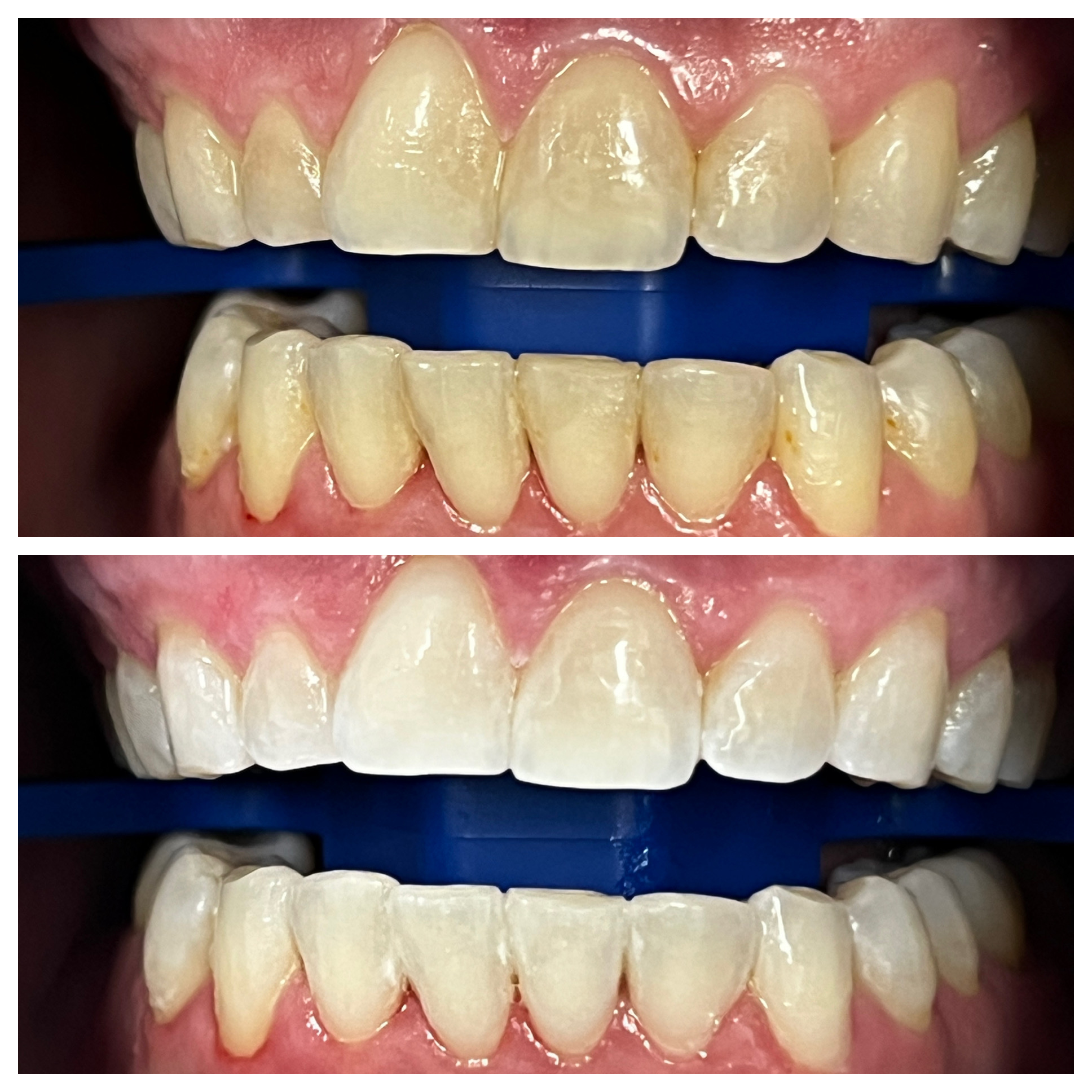 Smile Studio Norman | Implant Dentistry, Restorative Dentistry and Snoring Appliances