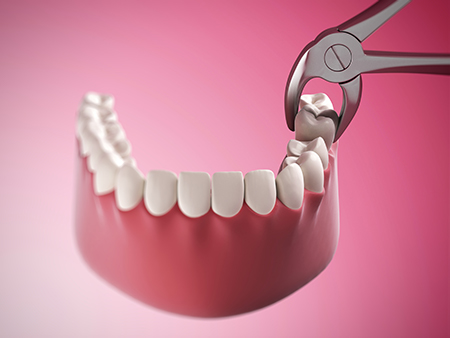 An advertisement featuring a dental implant with a screwdriver manipulating it, set against a pink background with a close-up view of an open mouth displaying the implant.
