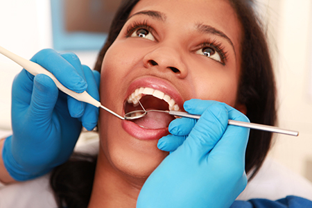 A woman receiving dental care with her mouth open wide while seated in a dentist s chair.